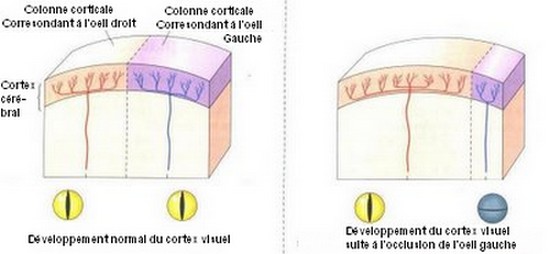 plasticit2.jpg